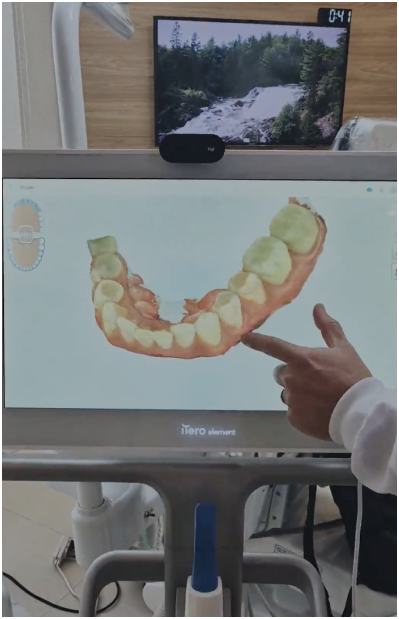 Scanner 3d